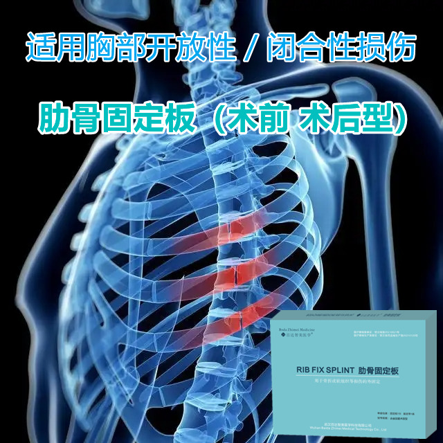 1753934725949726.jpg 胸骨固定板1.jpg