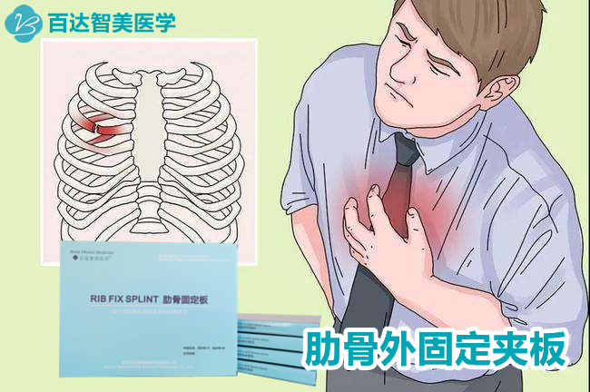 1753936271622874.jpg 肋骨固定板3_副本.jpg